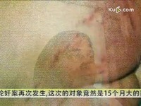 精彩花絮 轮奸<em>女婴</em>致其下体流血不止 <em>私处</em>惨不